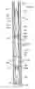 Fig. 01 - Method and apparatus for wellbore fluid treatment