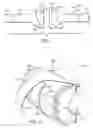 Fig. 02 - Deployment control device for air bag