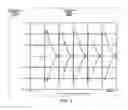 Fig. 06 - Simple time domain pulse generator