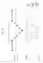 Fig. 09 - Bubble error rejecter in data converter