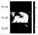 Fig. 13 - Automated medical image visualization using volume rendering with local histograms
