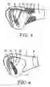 Fig. 11 - EYEGLASSES
