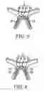 Fig. 12 - EYEGLASSES