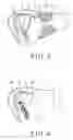 Fig. 15 - EYEGLASSES
