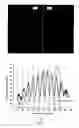 Fig. 03 - Optical sensing devices with SPR sensors based on differential phase interrogation and measuring method using the same