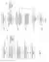 Fig. 04 - FAST INITIALIZATION USING SEAMLESS RATE ADAPTATION