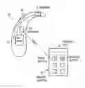 Fig. 02 - Hearing aid and method for its adjustment