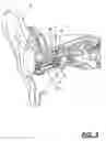 Fig. 04 - In the ear hearing aid utilizing annular acoustic seals