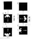 Fig. 07 - Optimizing use and performance of optical systems implemented with telecentric on-axis dark field illumination