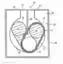 Fig. 01 - Method for handling an endless belt for an electrophotographic printer, and a storage unit having a retaining device for this endless belt