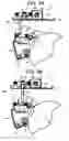 Fig. 04 - Cleaning device for removing toner from an image bearing member