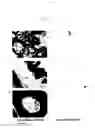 Fig. 05 - Squamous cell carcinoma antigens and use therefor