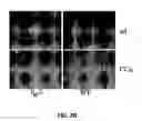 Fig. 07 - Methods for treating fibrotic conditions