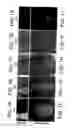 Fig. 02 - Methods and compositions for inhibiting tumorigenesis