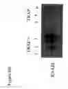 Fig. 07 - Methods and compositions for the treatment and prevention of and other bacterial infections