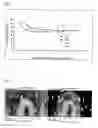 Fig. 08 - Optical recording medium