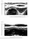 Fig. 08 - Optical recording medium