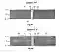 Fig. 09 - Force-introduction point in core composites and method for producing said point using reinforcement elements that traverse the thickness of the core composite