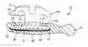 Fig. 01 - Packaging system for pre-pasted orthodontic bracket