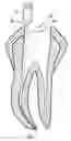 Fig. 01 - Methods for apical preparation using endodontic instruments made of super-elastic alloys