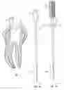 Fig. 02 - Methods for apical preparation using endodontic instruments made of super-elastic alloys
