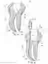 Fig. 06 - Methods for apical preparation using endodontic instruments made of super-elastic alloys