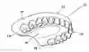 Fig. 01 - Flexible denture and method to make same