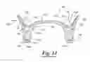 Fig. 07 - Flexible denture and method to make same