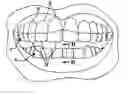 Fig. 01 - Dental template and method of visually demonstrating an overlay for a dental patient and setting the horizontal plane with an overlay