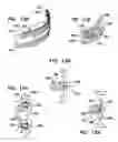 Fig. 08 - Device having activated textured surfaces for treating oral tissue
