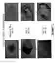 Fig. 02 - In vitro platform for screening agents inducing islet cell neogenesis