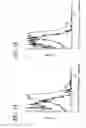 Fig. 02 - Negative correlation between IRP-2 and Transferrin receptor expression as a diagnostic of Alzheimer's disease