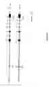 Fig. 09 - PGC-1β, a novel PGC-1 homologue and uses therefor