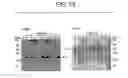 Fig. 74 - Paramyxovirus-derived RNP
