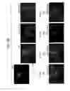 Fig. 87 - Paramyxovirus-derived RNP