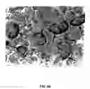 Fig. 08 - Nephrin gene and protein