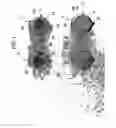 Fig. 02 - Artificial eye assemblies