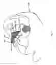 Fig. 07 - Artificial eye assemblies
