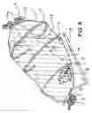 Fig. 07 - Device for protecting different articles against birds, insects and dust