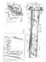 Fig. 02 - Electromagnetically insulated conduit and system