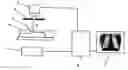 Fig. 01 - Apparatus and method for recording the movement of organs of the body