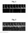 Fig. 02 - Apparatus and method for processing an ultrasound spectrum image