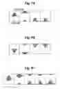 Fig. 09 - Apparatus and method for processing an ultrasound spectrum image