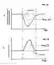 Fig. 02 - General and localized corrosion rate measurements