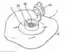 Fig. 01 - Nozzle device for vacuum container