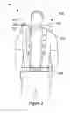 Fig. 03 - MODULAR PERSONAL CARRYING SYSTEM
