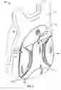 Fig. 02 - Backpack with expandable area