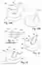 Fig. 06 - Weld metal material apparatus and method