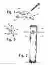 Fig. 02 - Fence wire fastener