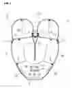 Fig. 03 - Airbag device
